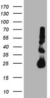 TIMP2 Antibody