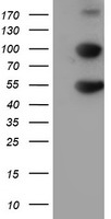 HARS2 Antibody