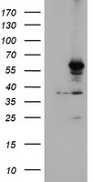 CYP2A6 Antibody