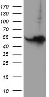 HARS2 Antibody