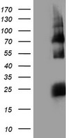 HARS2 Antibody