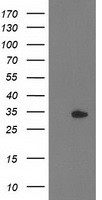 HDHD2 Antibody