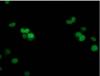 TP53 Antibody