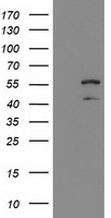 KATNAL1 Antibody