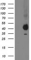 PON1 Antibody