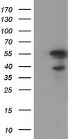 KATNAL1 Antibody