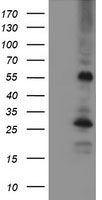 MEF2C Antibody