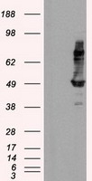 IFT57 Antibody