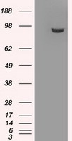 GBE1 Antibody