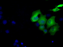 Sorbitol Dehydrogenase Antibody
