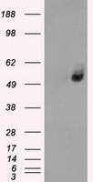 SLC2A6 Antibody