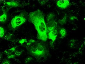 GFAP Antibody