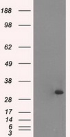 Cardiac Troponin I Antibody