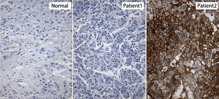 HBsAg Antibody