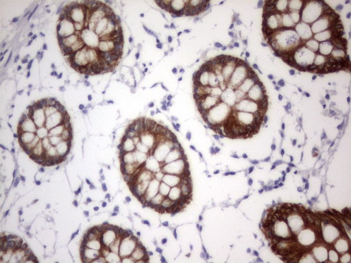 Acidic CK Antibody