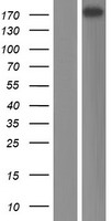 CPS1 Human Over-expression Lysate