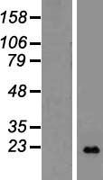 LTA Human Over-expression Lysate