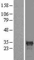 CDX1 Human Over-expression Lysate