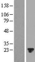 CRYBA4 Human Over-expression Lysate