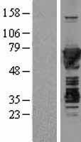Moesin (MSN) Human Over-expression Lysate