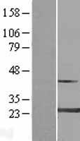 Myosin (MYL4) Human Over-expression Lysate