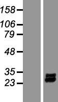 PDGF AA (PDGFA) Human Over-expression Lysate
