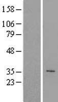 PEX10 Human Over-expression Lysate