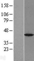 PRPSAP1 Human Over-expression Lysate