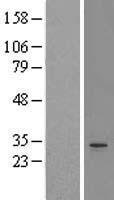 PSMA1 Human Over-expression Lysate