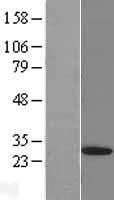 PSMD9 Human Over-expression Lysate