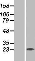 RGS10 Human Over-expression Lysate