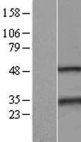 SSX2 Human Over-expression Lysate
