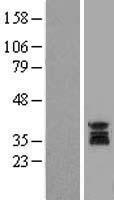 UNG Human Over-expression Lysate
