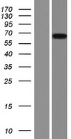 PIP5K1 alpha (PIP5K1A) Human Over-expression Lysate