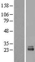 RRP1 like protein (RRP1) Human Over-expression Lysate