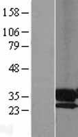 PPAP2A (PLPP1) Human Over-expression Lysate
