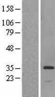 HSD17B6 Human Over-expression Lysate