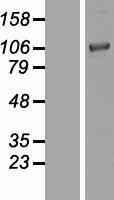 Chordin (CHRD) Human Over-expression Lysate