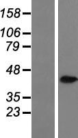 AKR1C3 Human Over-expression Lysate