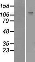 IRS2 Human Over-expression Lysate