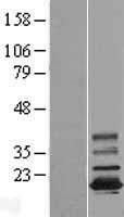 TMEM11 Human Over-expression Lysate