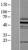 ZNF259 (ZPR1) Human Over-expression Lysate