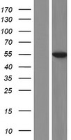 L Kynurenine Hydrolase (KYNU) Human Over-expression Lysate