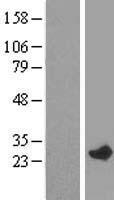 RAB7L1 (RAB29) Human Over-expression Lysate