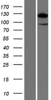 HIP1R Human Over-expression Lysate