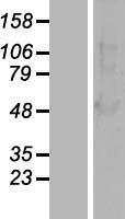 beta Arrestin 1 (ARRB1) Human Over-expression Lysate