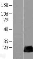 RHOB Human Over-expression Lysate