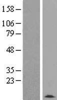 TMSB4Y Human Over-expression Lysate