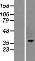 GET3 Human Over-expression Lysate