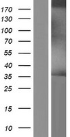 DHLAG (CD74) Human Over-expression Lysate